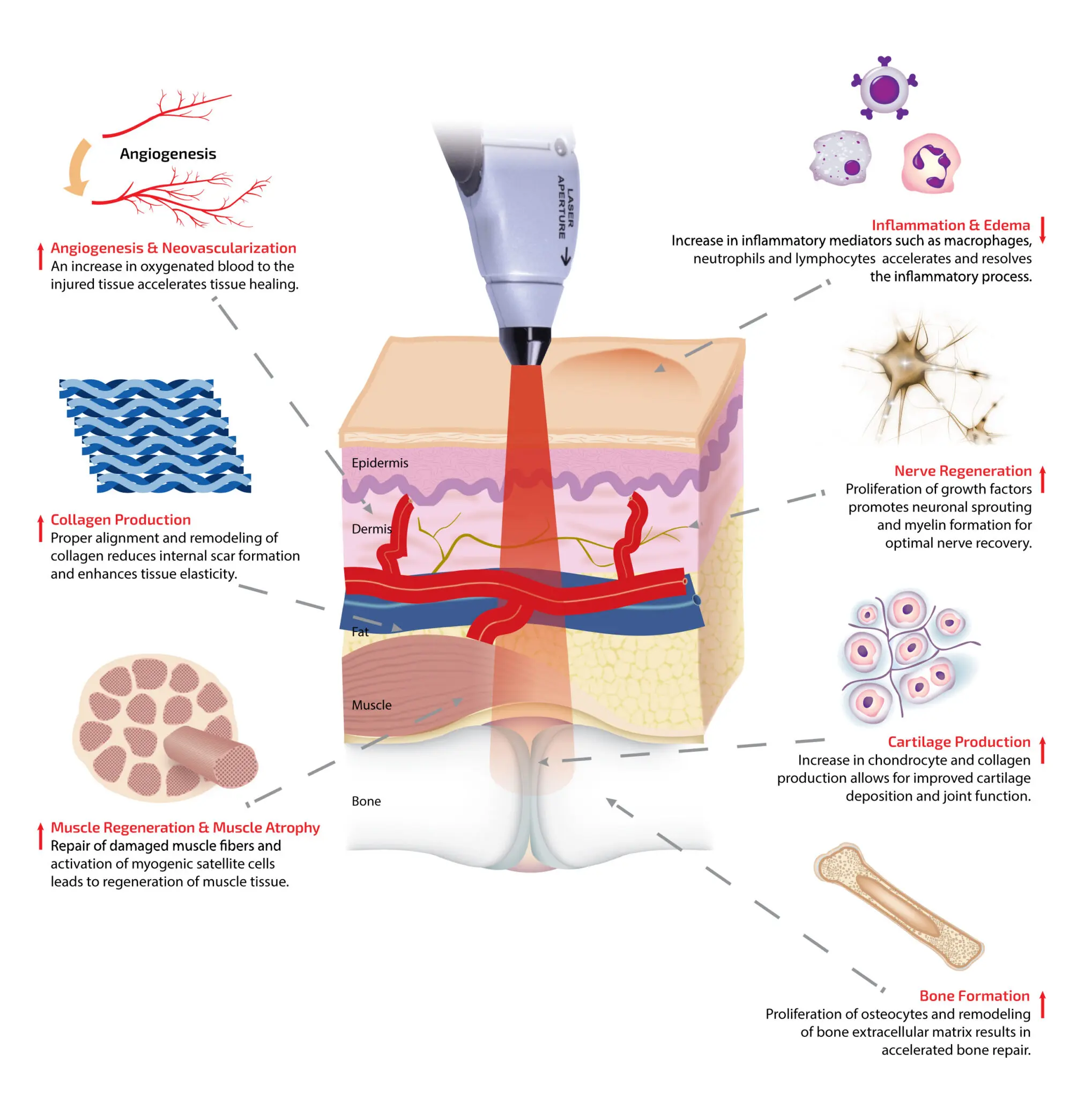 bioflex laser